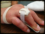Occupational Therapy, Hand Rehab, Hands Rehabilitation, Upper Extremity Rehab, Upper Extremity Rehabilitation, hand therapy, hands on therapy, Splinting, Upper Extremity Splinting, Rehabilitation Services