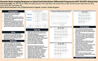 Dynamic Brain Imaging response to SCS Poster.jpg