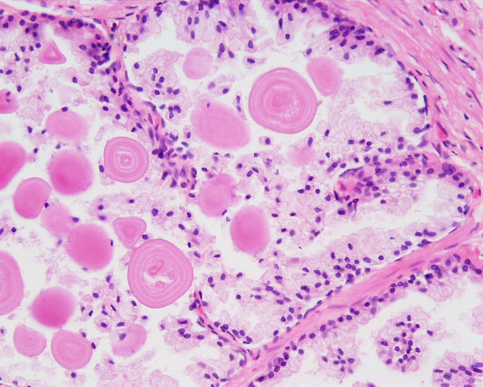 prostata3.jpg