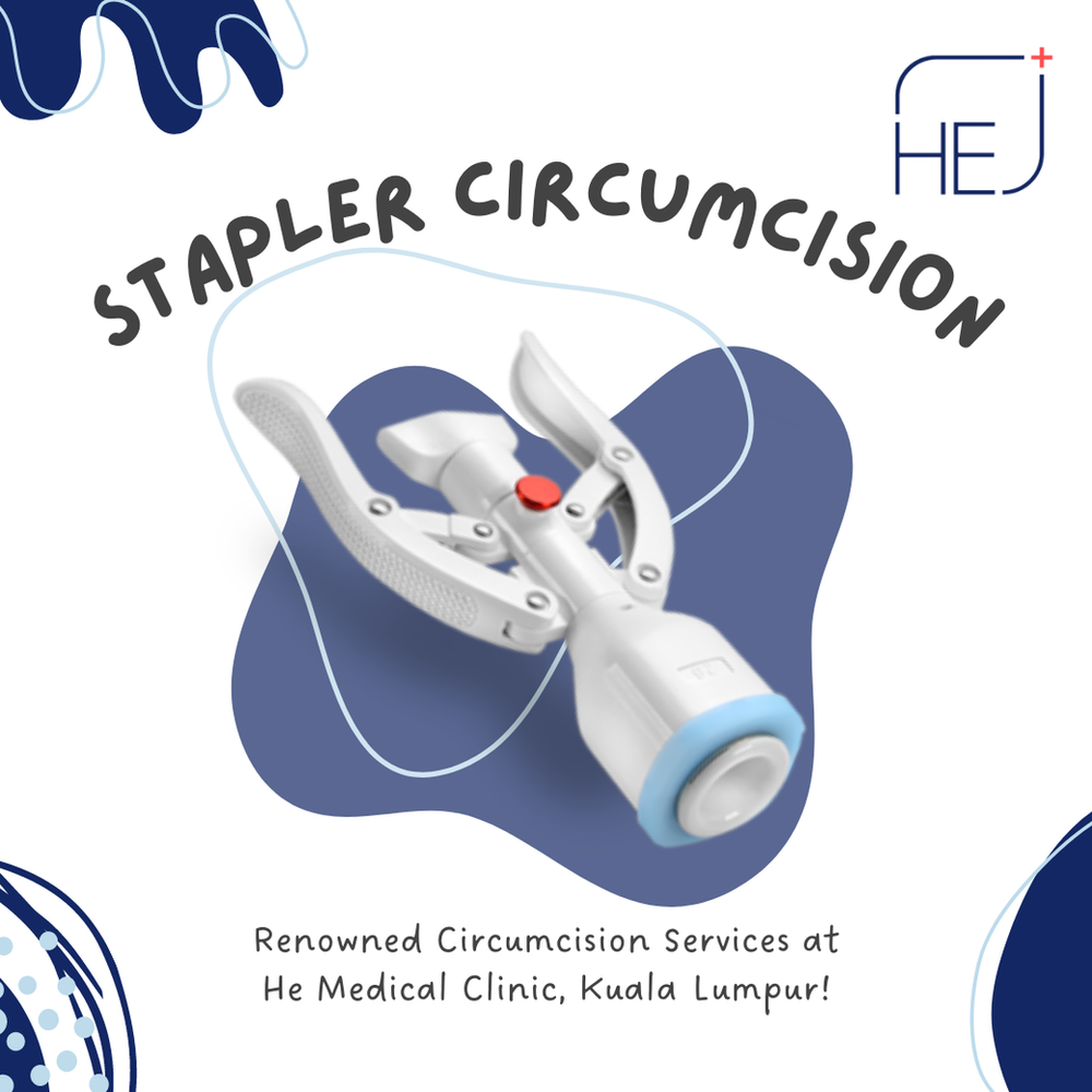 Stapler Circumcision In Malaysia Get Your Treatment Done At The Clinic