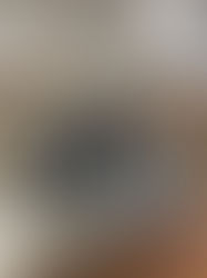 An Unexpected Opening to a Deeper Gratitude: Guillain Barre Syndrome