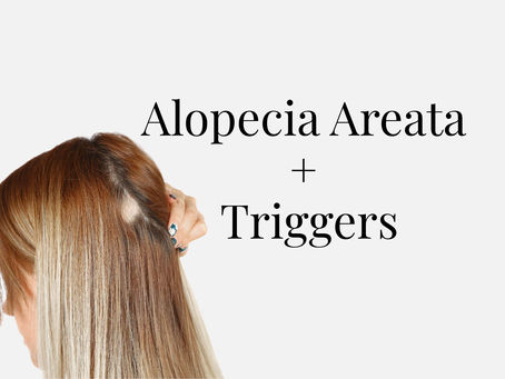 Alopecia Areata spot on woman