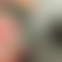 Bala perdida atinge cabeça de recém-nascida em hospital