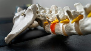 Disc Herniation: What You Need to Know (And Why It Doesn't Have to Be Scary)