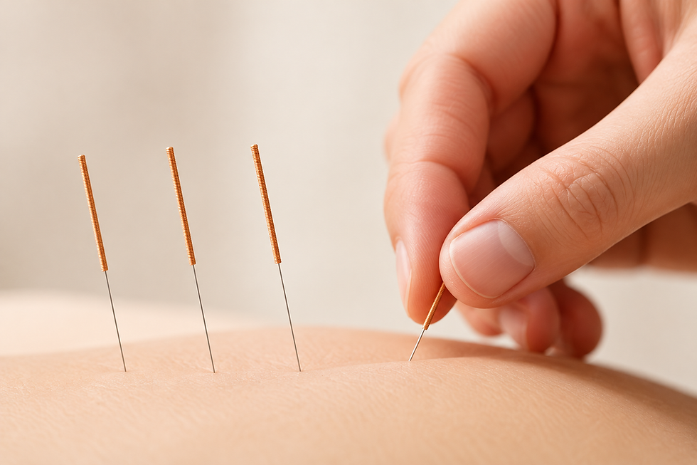 Acupuncture treatment at Skin Recovery Centre
