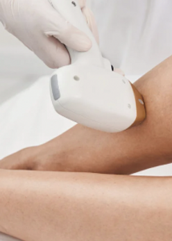Laser treatments