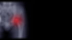 Photo: X-Ray of Person with Perthes