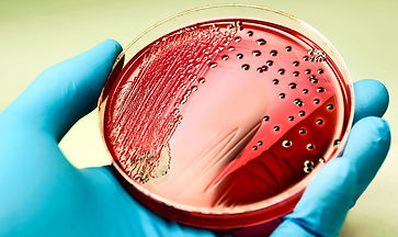 Salmonella.jpg