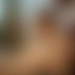 How Acupuncture Can Help You Stay Balanced During the Holidays