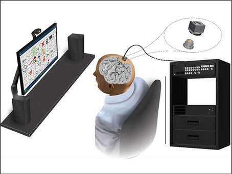 5 Minute Healthtech Jargon Buster: Brain Computer Interfaces