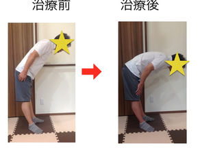 ぎっくり腰