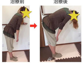 ぎっくり腰
