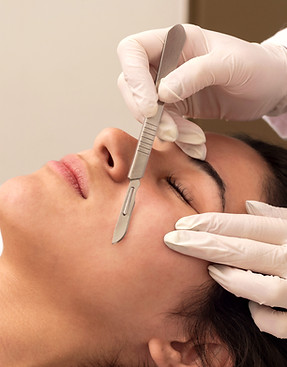procedure-dermaplaning.jpg