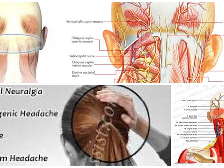 Headache, Migraine, Neck Pain