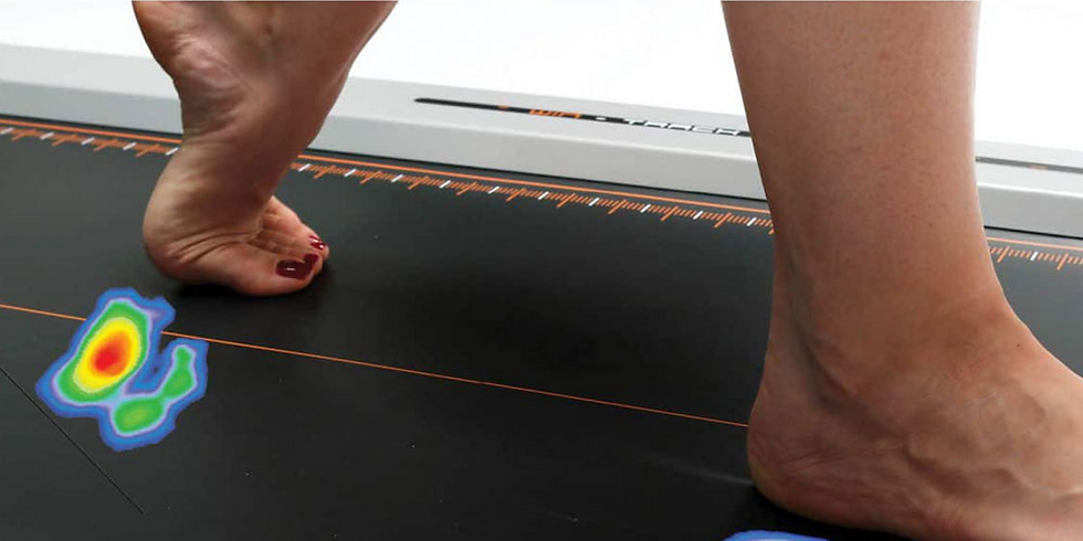 Plantar pressure distribution