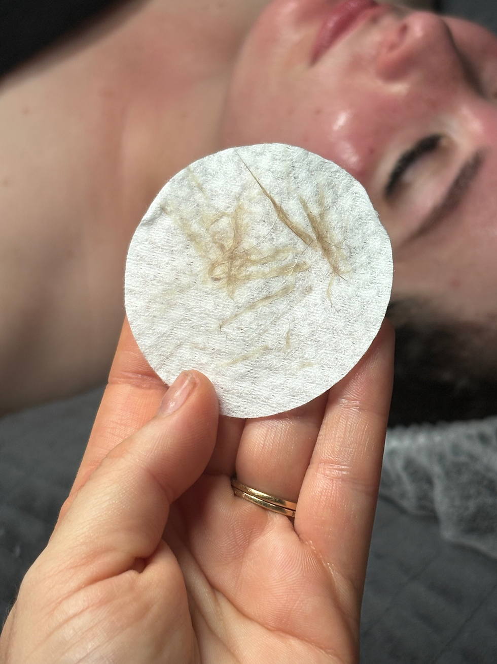 Dermablading