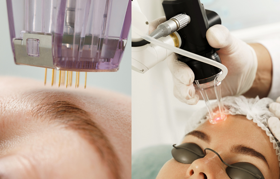 Microneedling vs. Laser: Which Skin Rejuvenation Treatment Is Right for You?