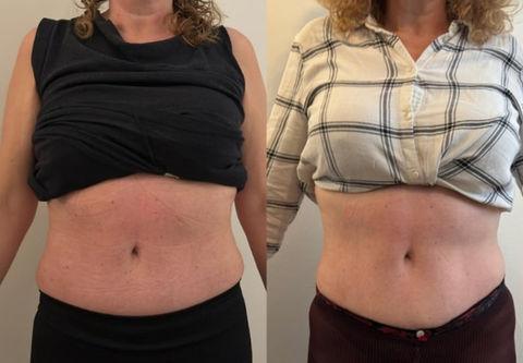 before and after photos