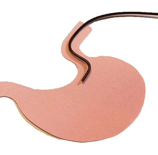 2025年度の湖南市胃がん内視鏡検診検査数のご報告