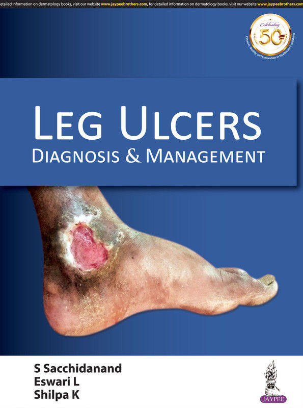 Pyoderma Leg Ulcer Leg Ulcers Diagnosis & Management | Drive de Estudos