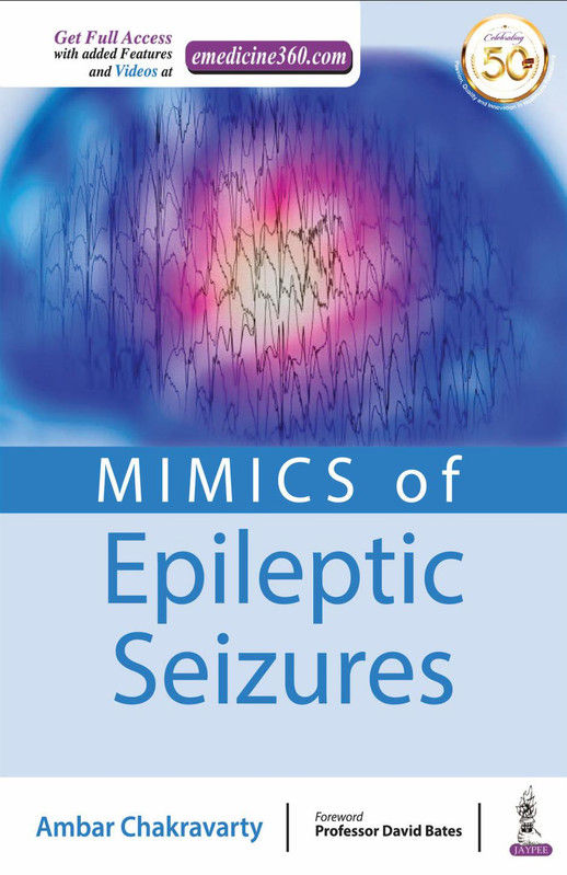 Mimics of Epileptic Seizures