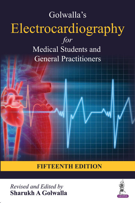 Golwalla’s Electrocardiography for Medical Students and General Practitioners,