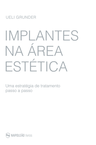 Implantes na área estética: uma estratégia de tratamento passo a passo