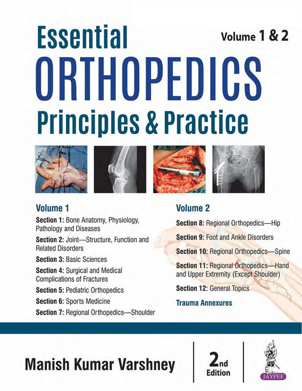 Essential Orthopedics Principles & Practice