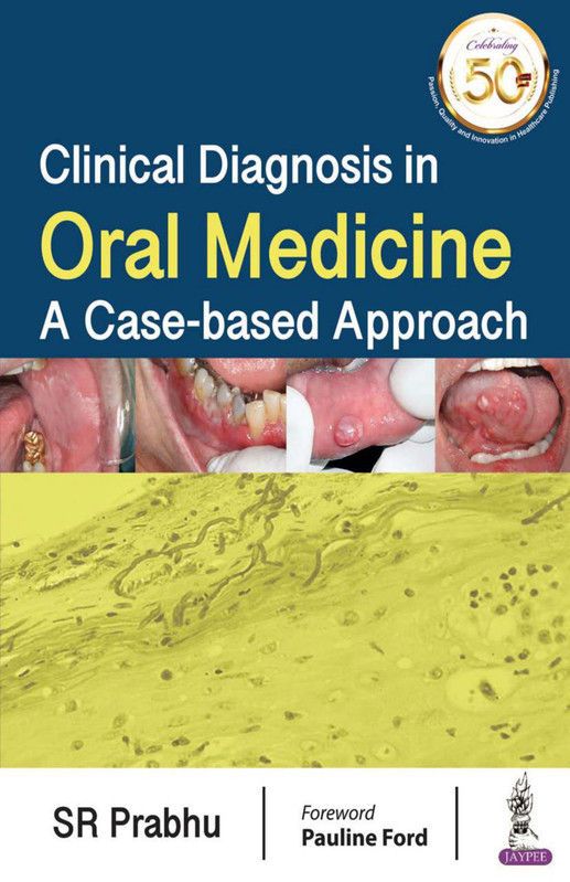 Clinical Diagnosis in Oral Medicine