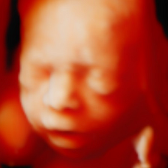 5D/HD Ultrasound Image