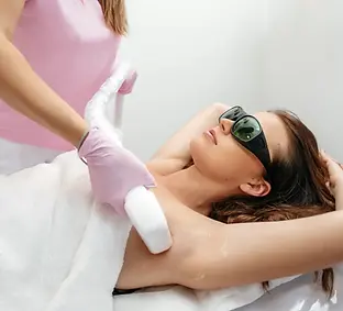 Depilación Laser.webp