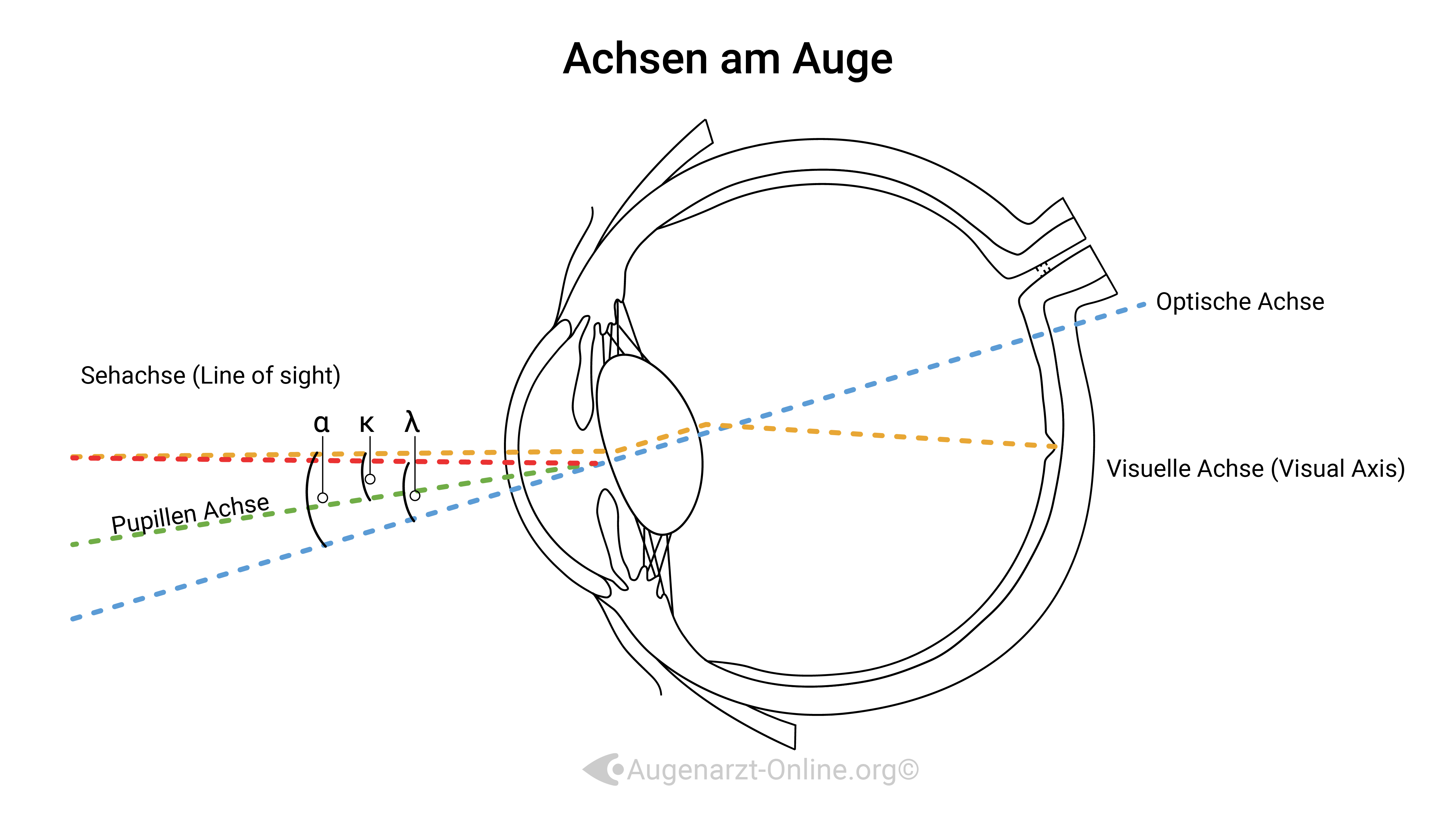 Achsen im Auge-Illustration-00000004-Tilt-Zentrierung-Optische Achse-Pupillen Achse--Seh A.jpg