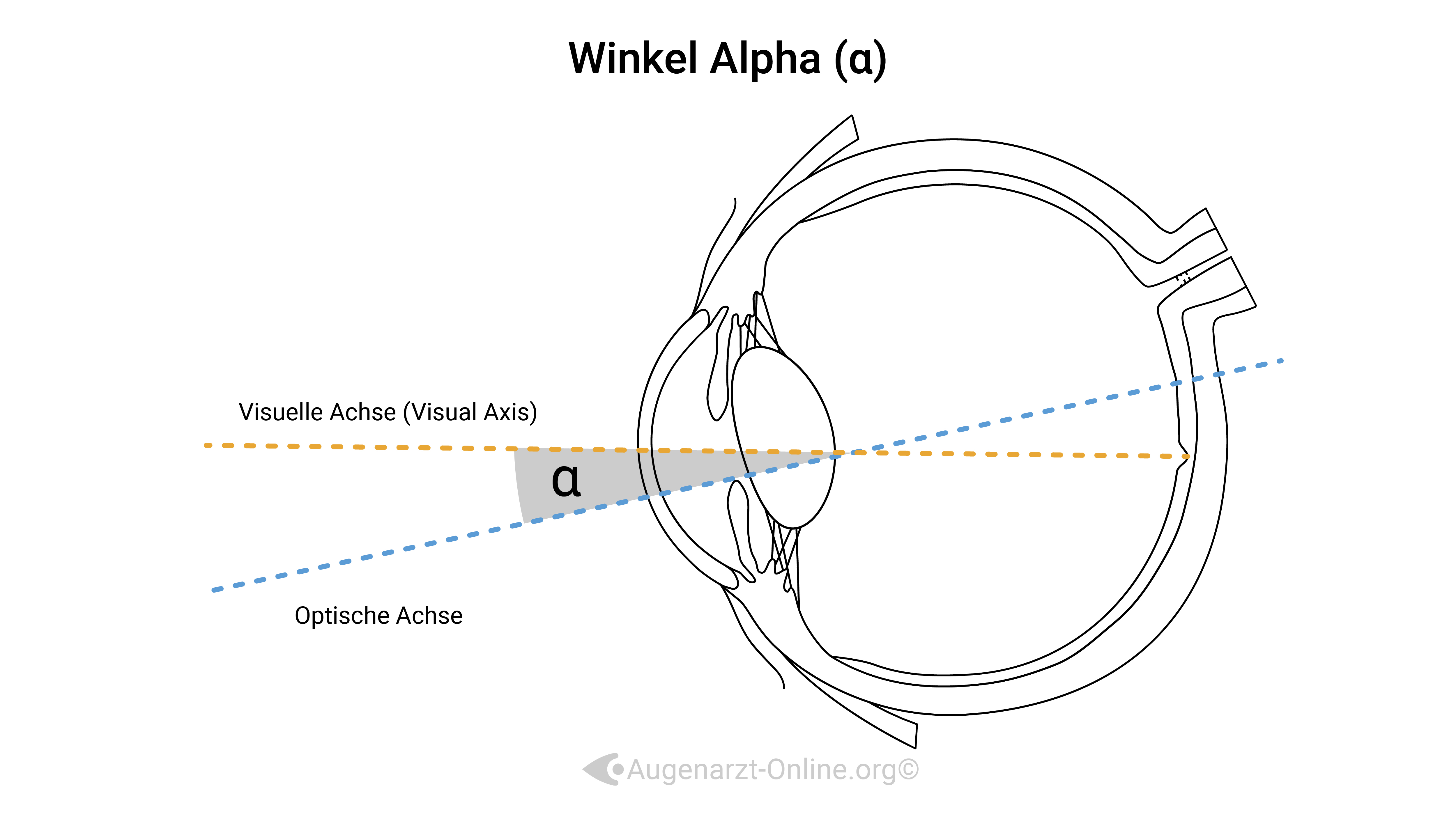 Achsen im Auge-Illustration-00000007-Winkel Alpha.jpg
