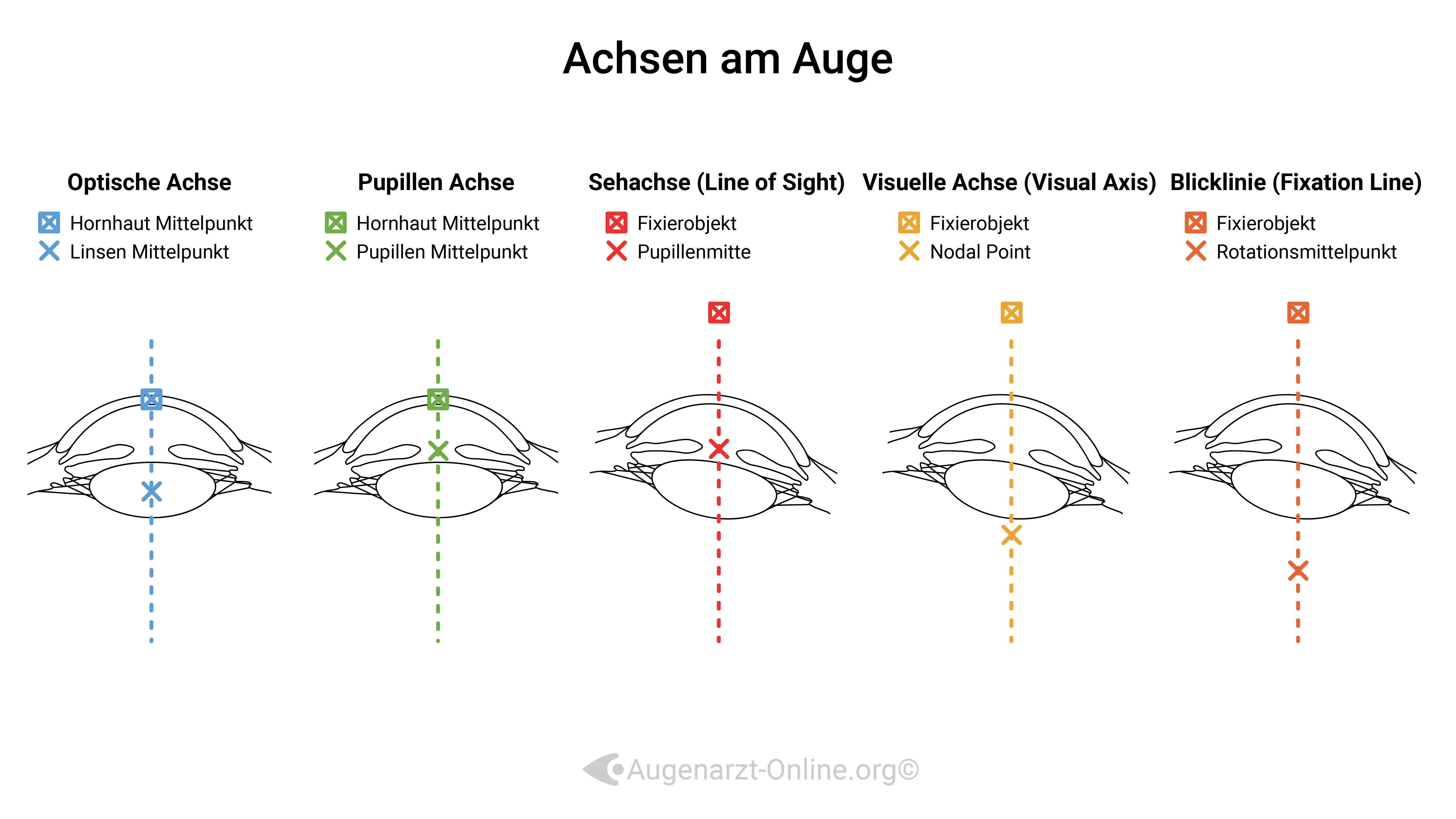 Achsen im Auge-Illustration-00000003-Tilt-Zentrierung-Optische Achse-Pupillen Achse--Seh A.jpg