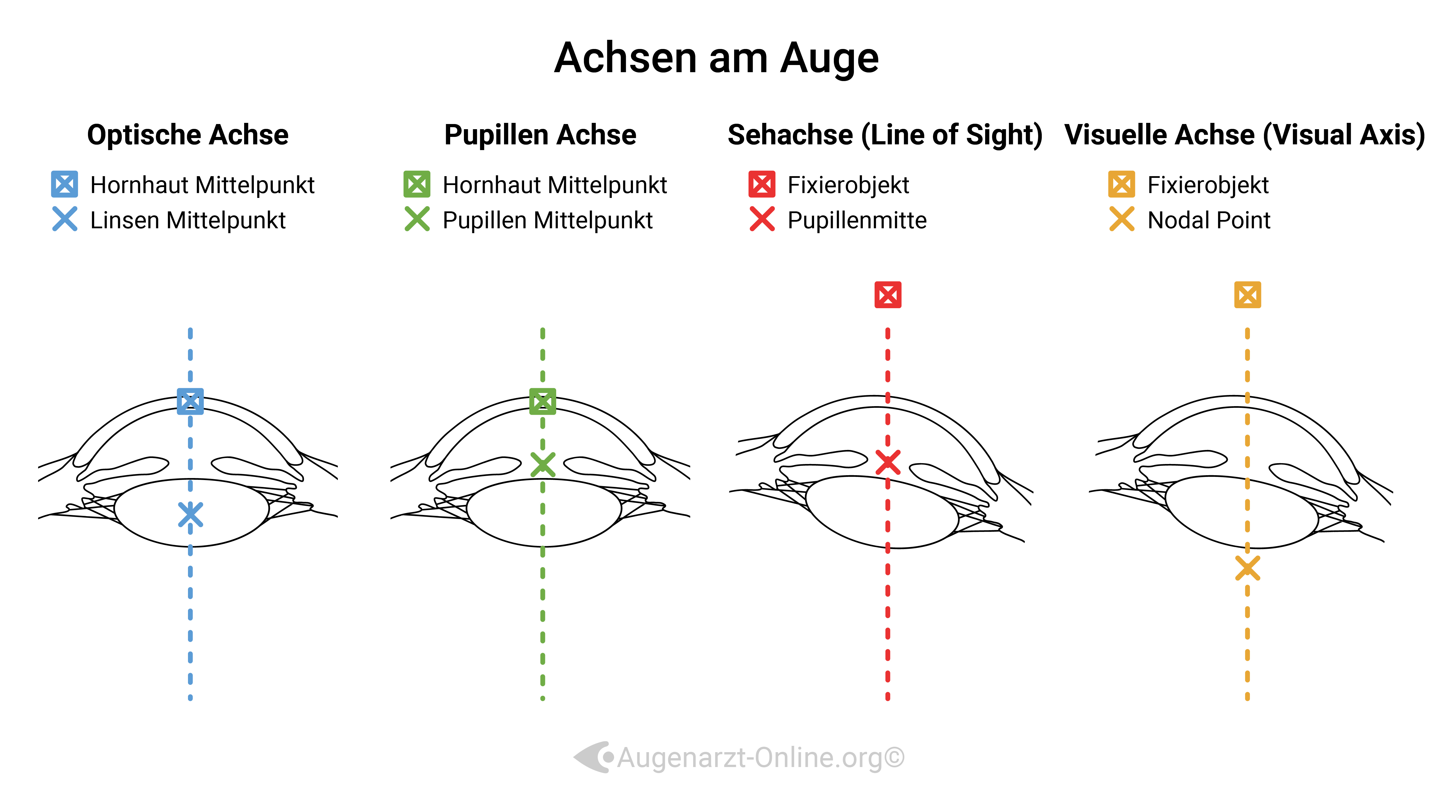 Achsen im Auge-Illustration-00000002-Tilt-Zentrierung-Optische Achse-Pupillen Achse--Seh A.jpg