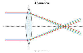 Aberration, Illustration, Krankheiten, Netzhaut, Augenheilkunde, Ophthalmologie, Augenerkrankung, Augenarzt, Linse Optik Physik, Schaubild, Infografik, Lernbild, Erklärung, Erklaerung, Übersicht, Uebersicht