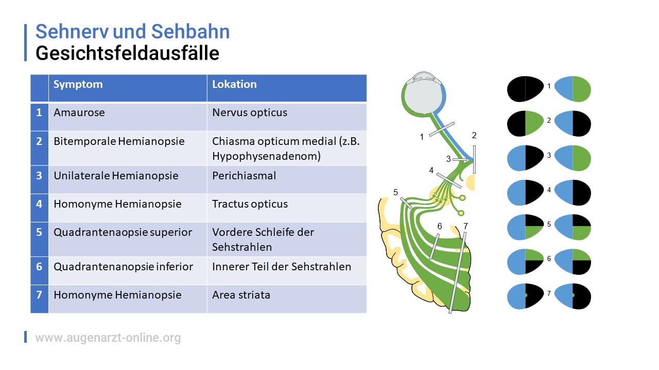 Gesichtsfeldausfälle-Illustration-00000001-Sehnerv und Sehbahn.jpg