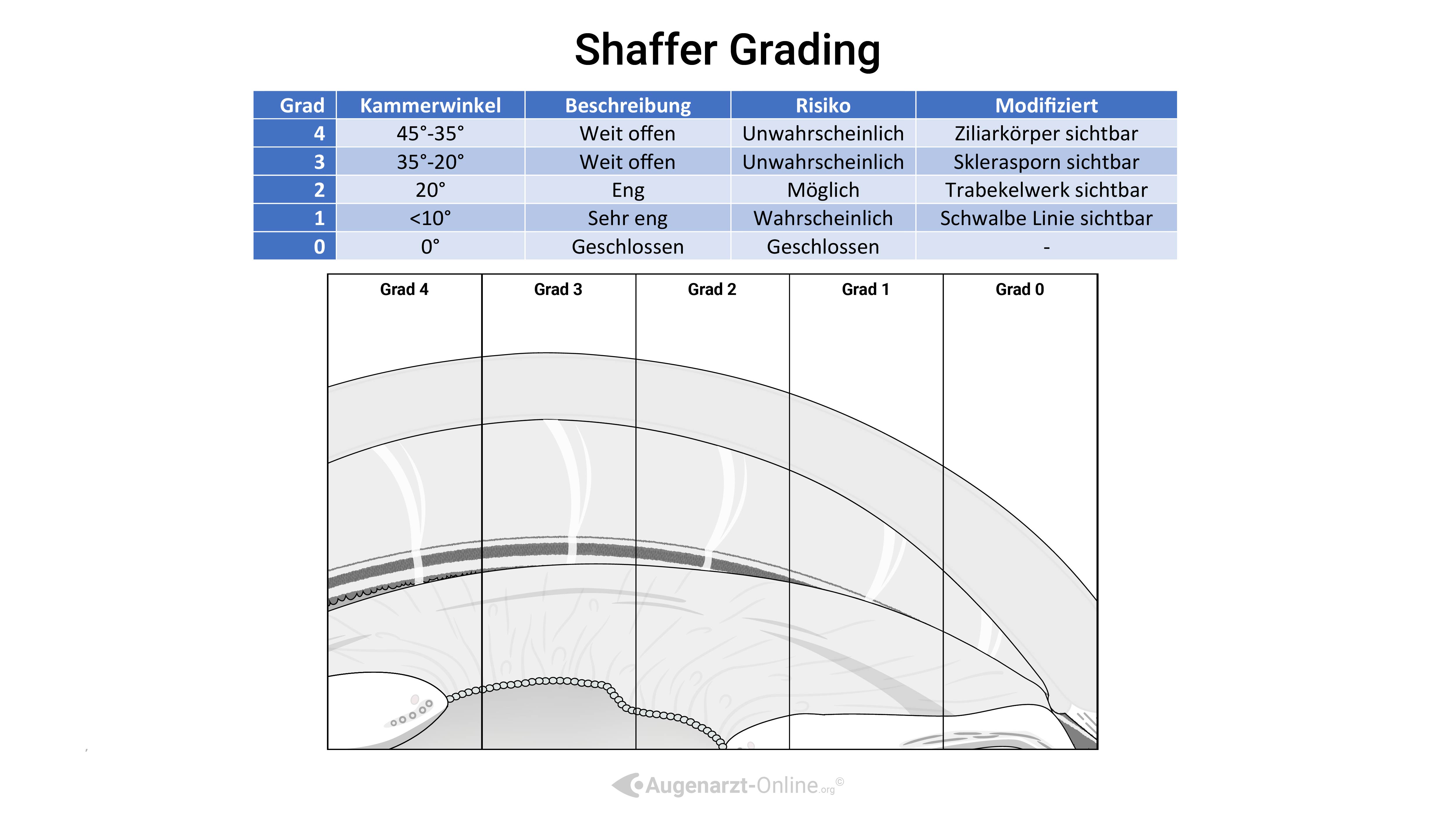 Kammerwinkelbeurteilung Shaffer Klassifikation