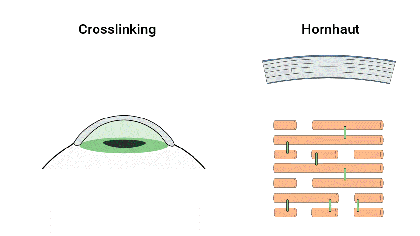 Crosslinking-Animation Erklärung.gif