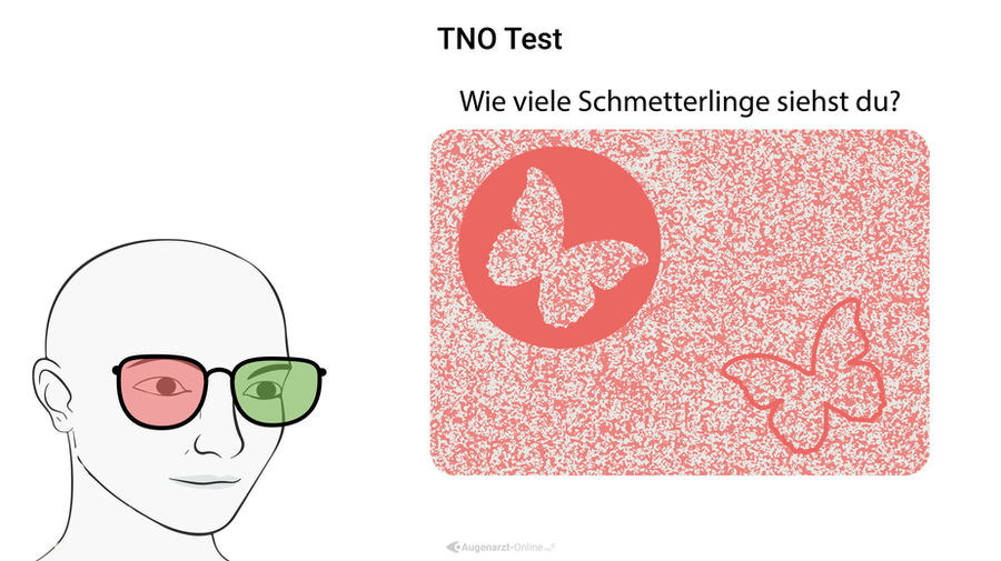 TNO Test