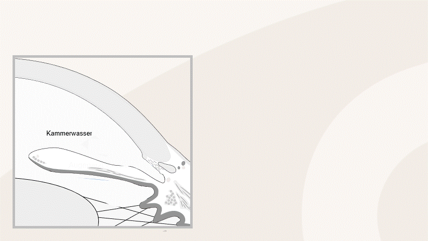 SLT Laser- Glaukom Laser Erklärung .gif