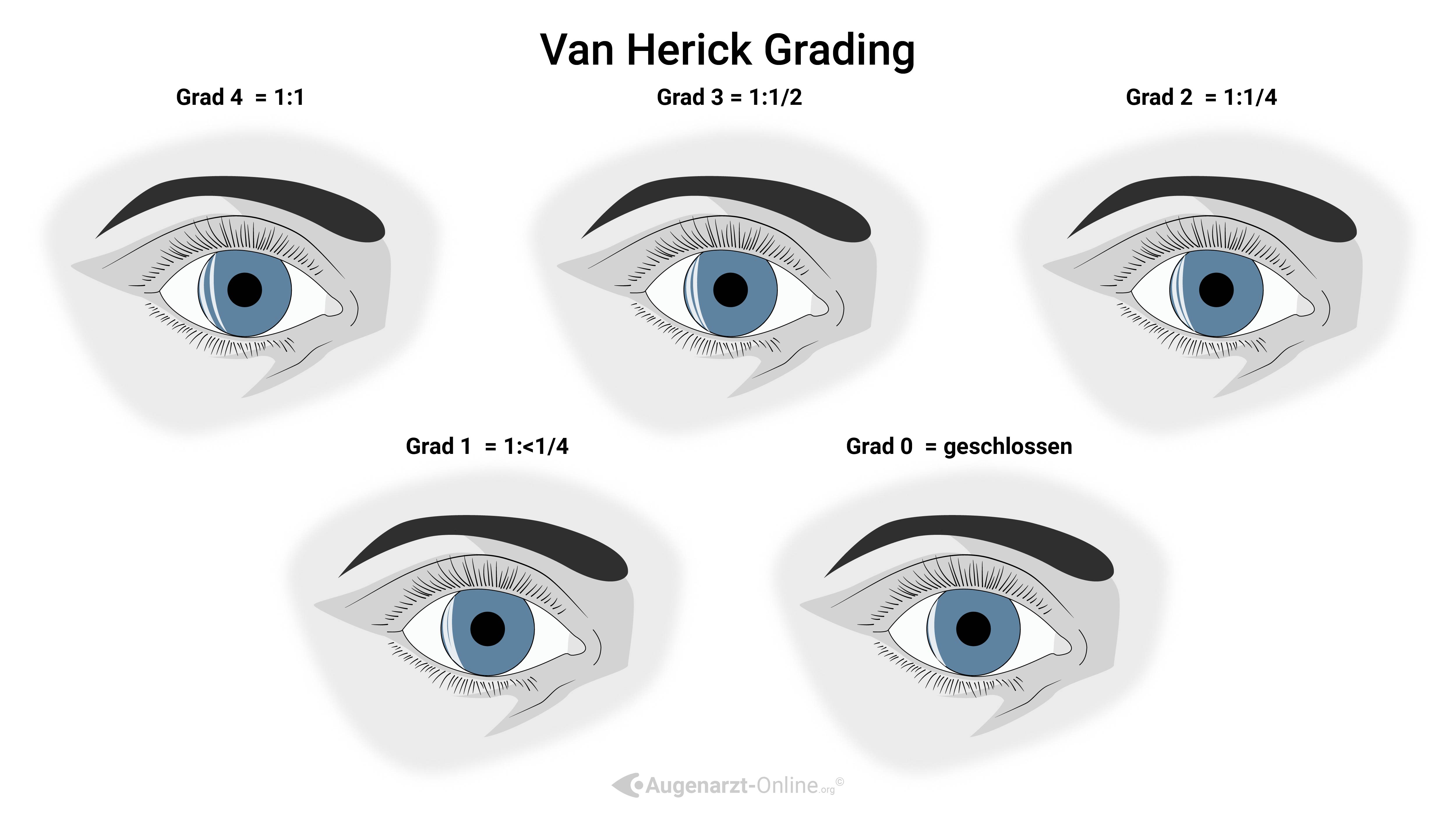 Van Herrick Klassifikation