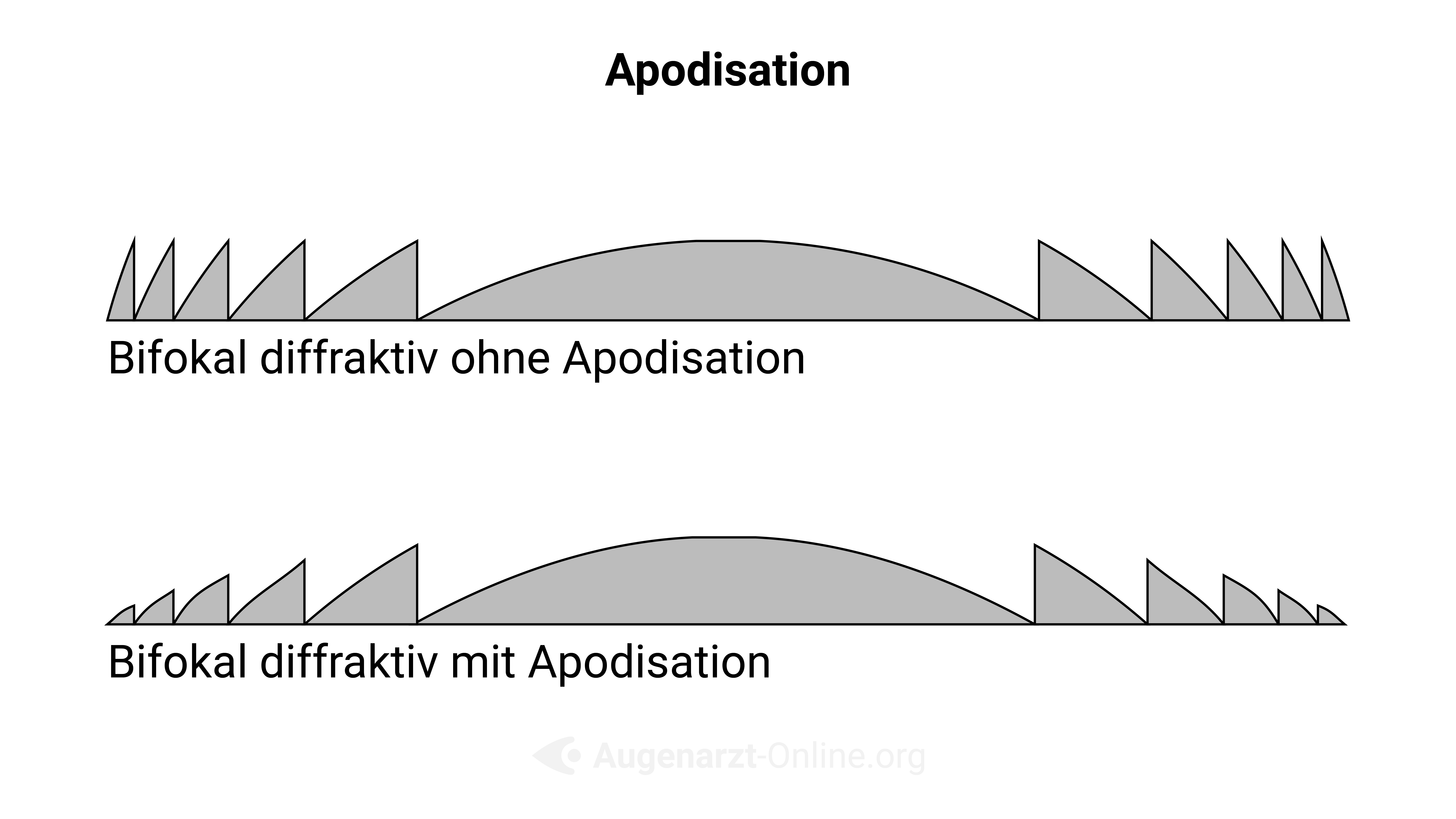 Apodisation diffraktiver Linsen