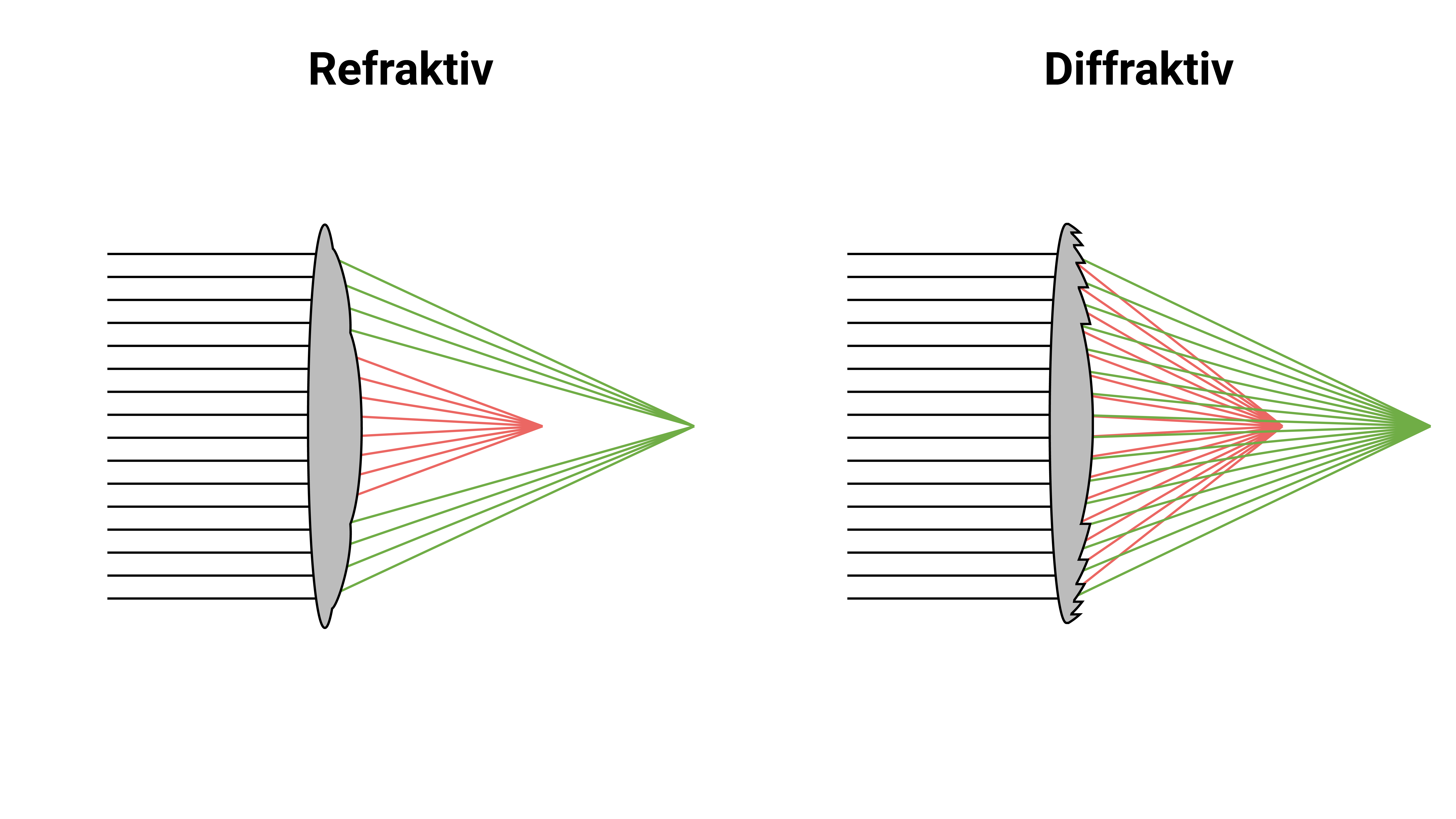 Refraktive vs. diffraktive Multifokallinsen
