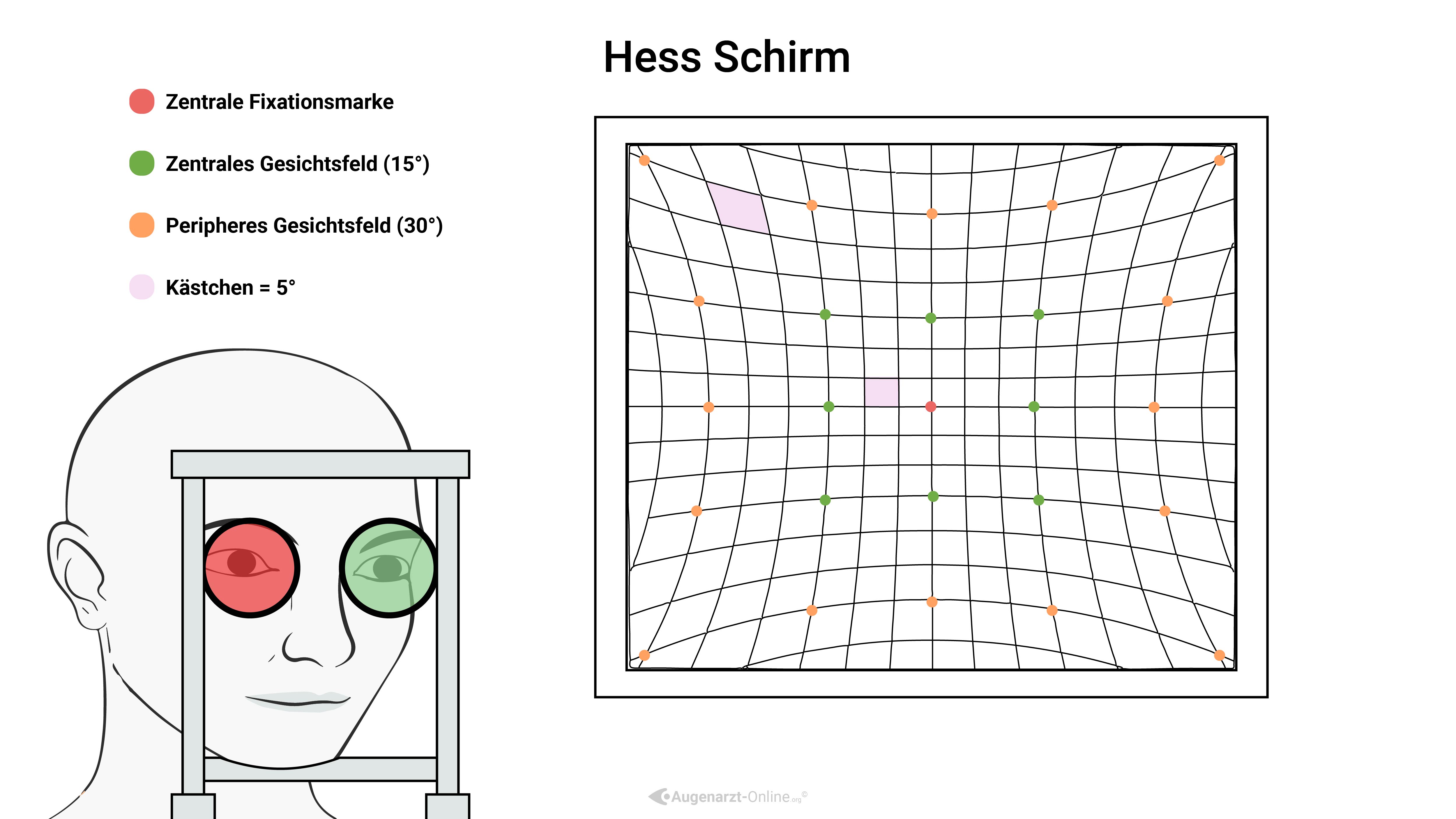 Hess Chart