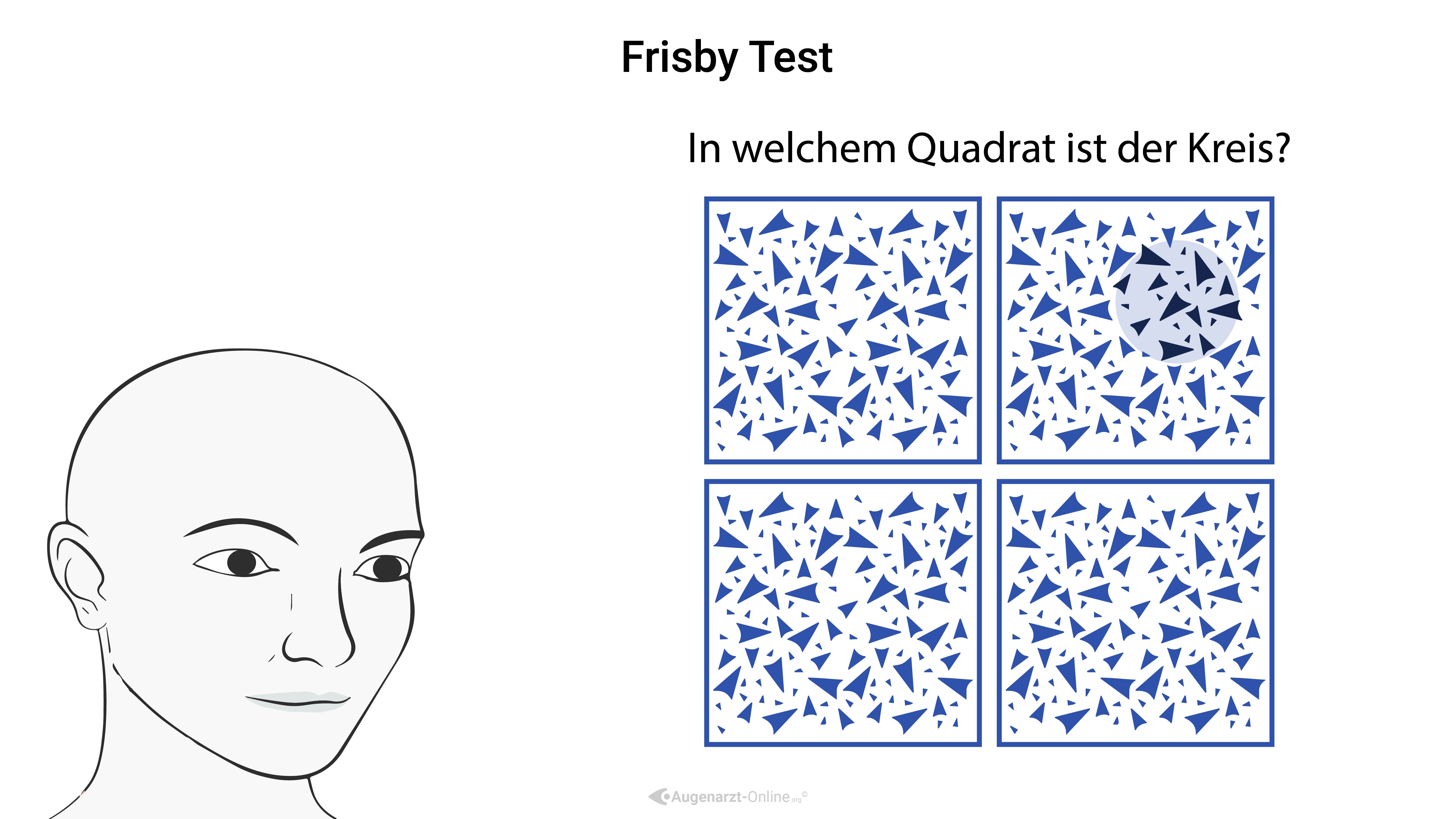 Frisby Test