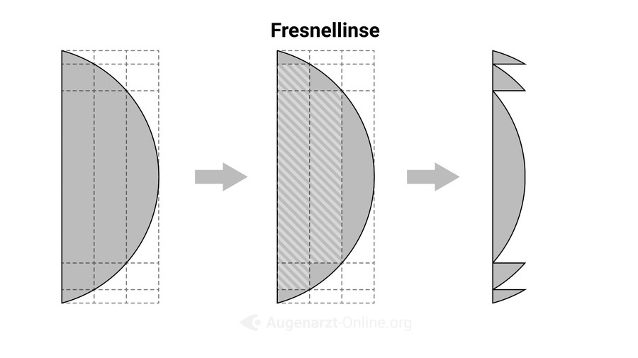 Fresnel Linse | Lexikon der Augenheilkunde