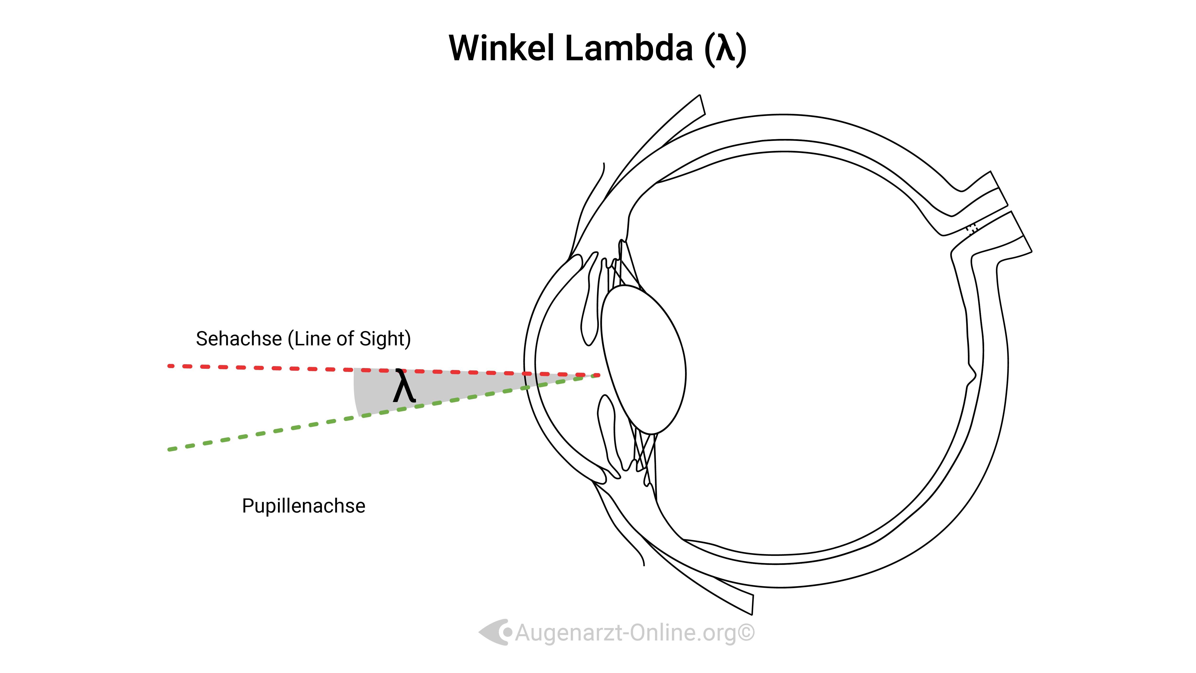 Achsen im Auge-Illustration-00000010-Winkel Lambda.jpg