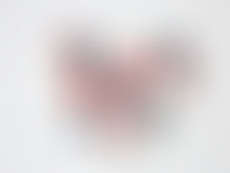 Un ensayo muestra el primer medicamento para intolerantes a las estatinas