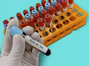 En el mundo hay 400 000 pacientes que padecen de hemofilia